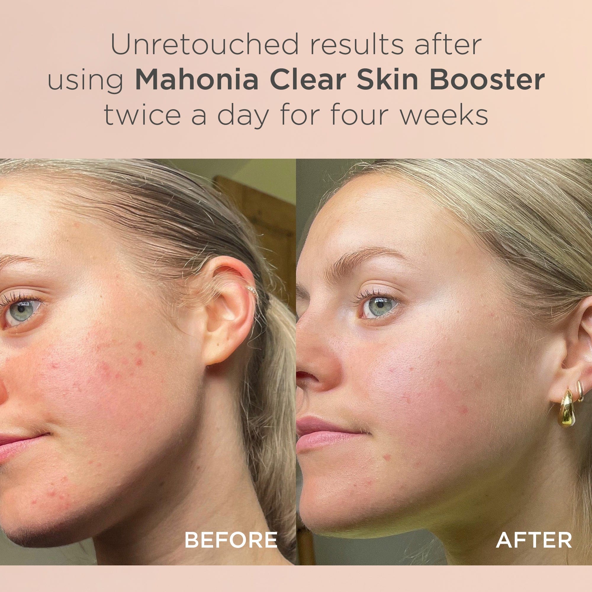 Mahonia Clear Skin Booster 25ml - Image 4